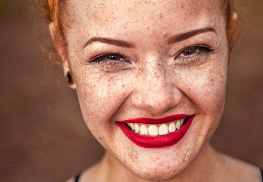 girl-freckles