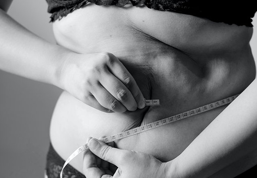 weightloss