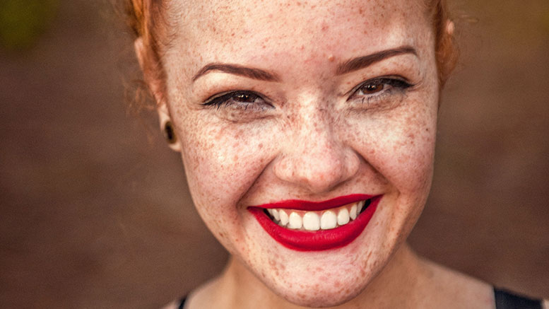 girl-freckles.jpg